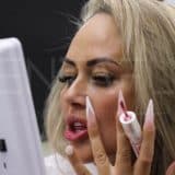 Patient from UK smile design