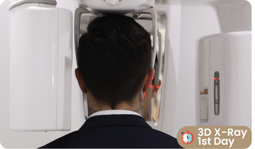 3D XRAY Step for all on six antalya