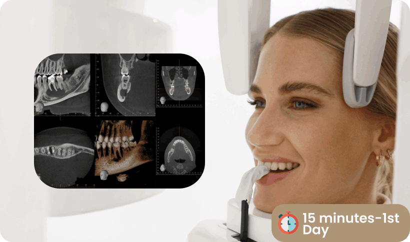 smile design 1st step Antalya smile design Antalya