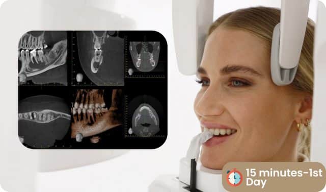 Smile Design Process in Antalya