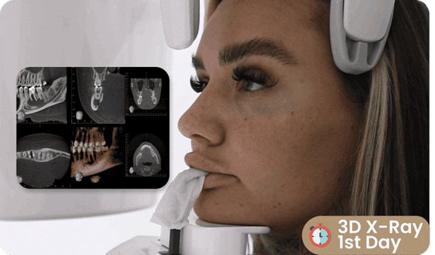 zirconium crowns Antalya zirconium crowns Antalya