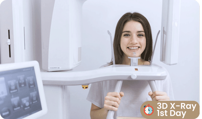 E-Max Veneers First Step