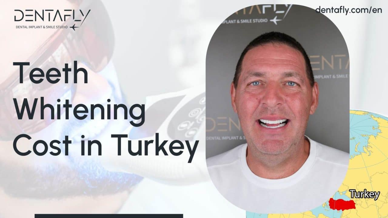 Teeth Whitening Cost in Turkey