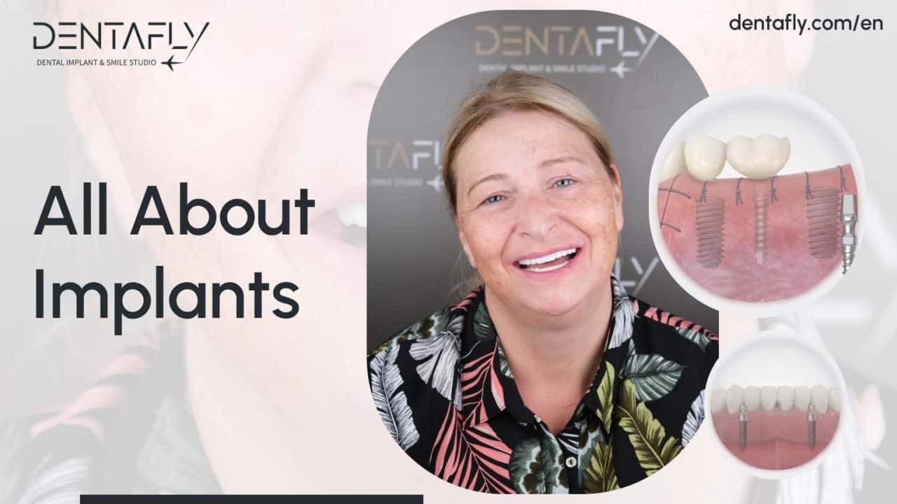 all about implants