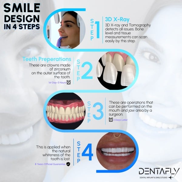 how-to-smile-design-in-4-steps- how to deliver smile design in 4 days