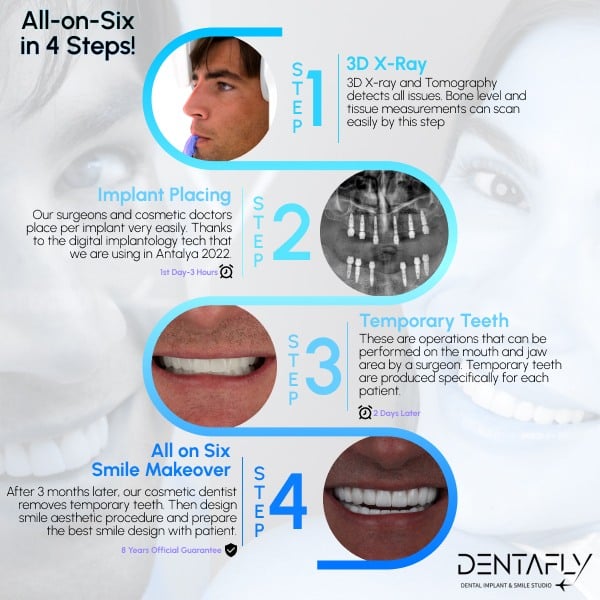 All on Six Procedure in Antalya