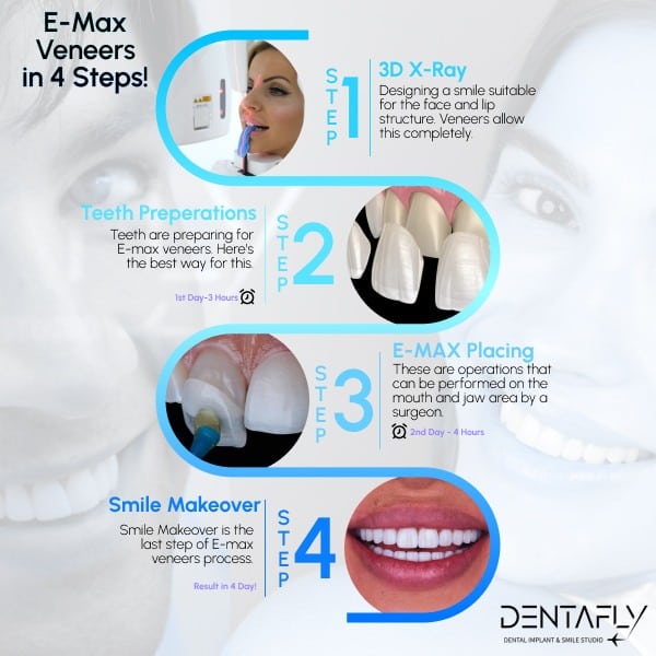 e-max laminate veneers procedure