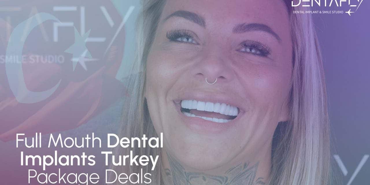 Full Mouth Dental Implants in Turkey: Full Guide for Everyone