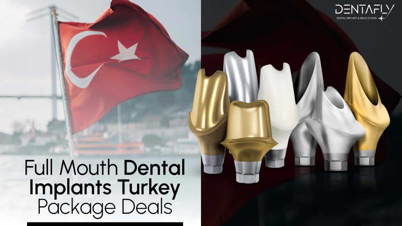 Full mouth dental implant packages