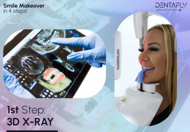 1st Step in Smile Makeover
