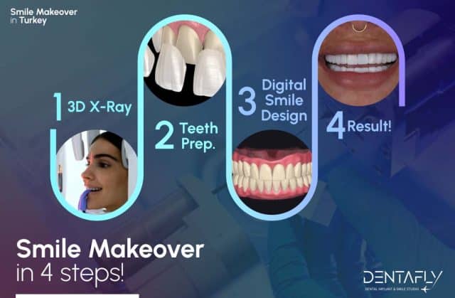 Smile makeover in Turkey: All Steps