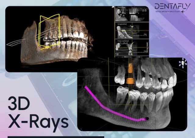 View of 3D X-Rays