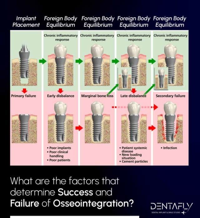 osseointegration success ratio