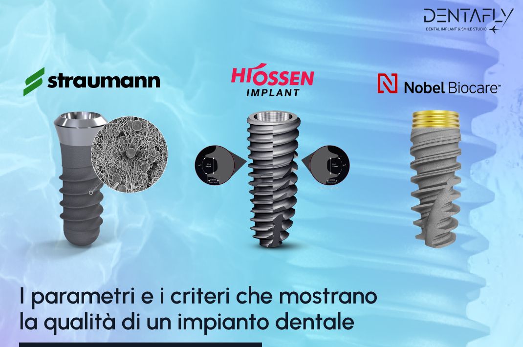 qualita di un impianto dentale