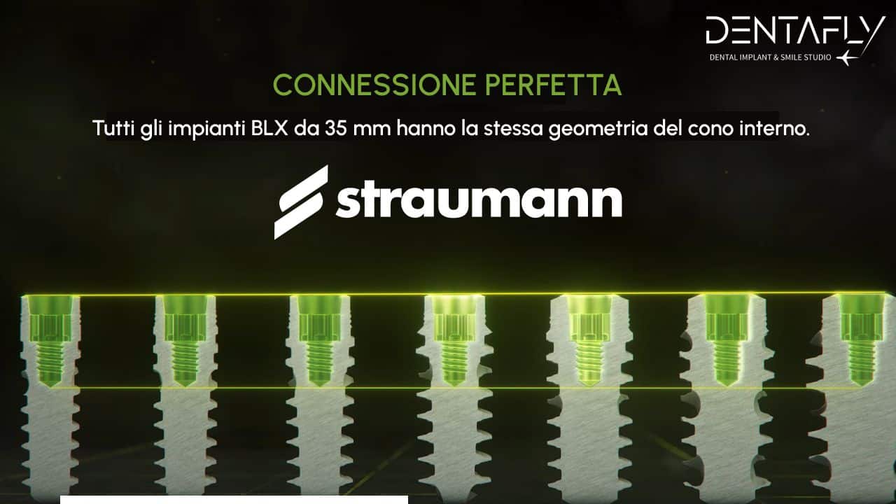 una connessione