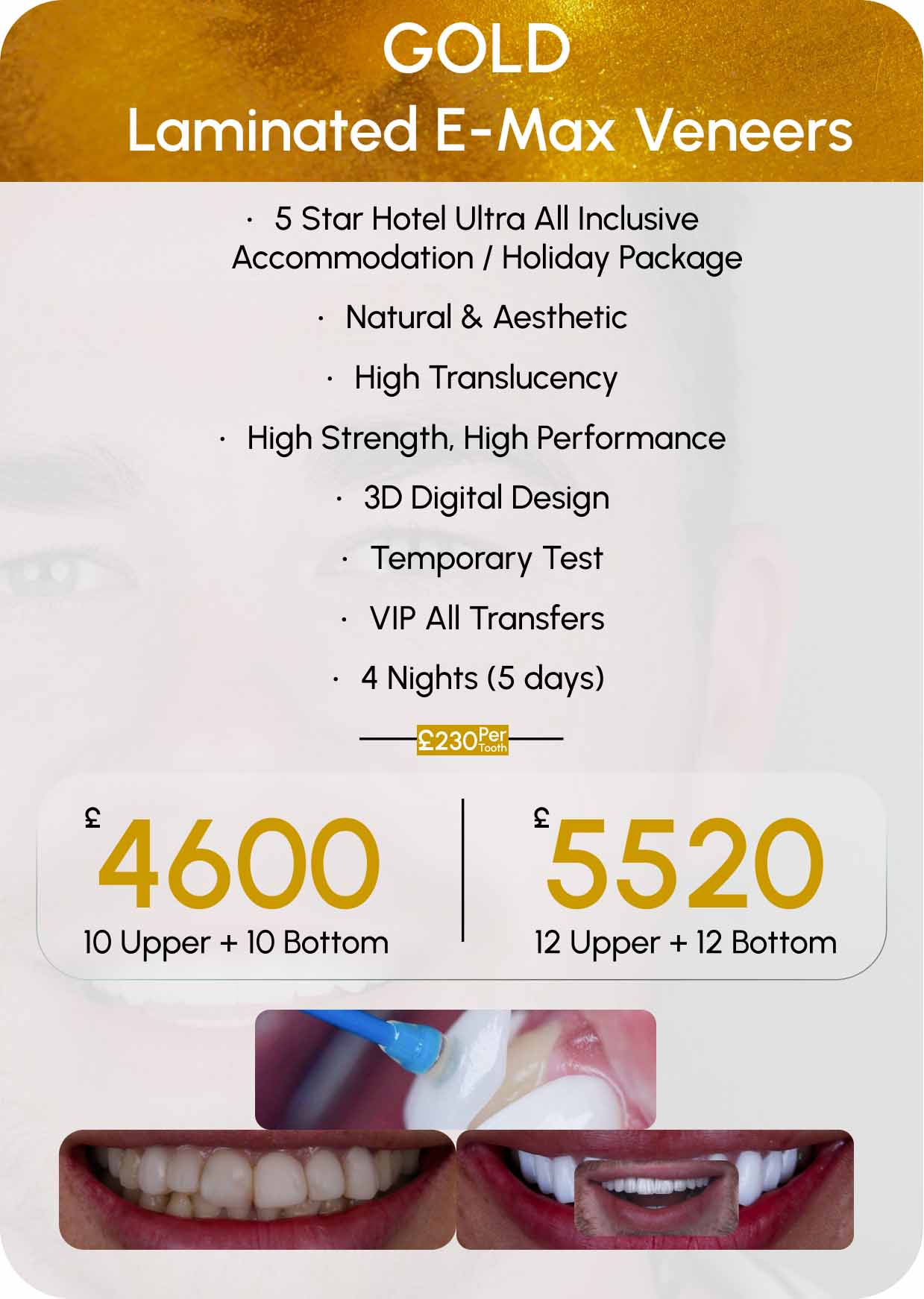 Laminate E-Max Veneers