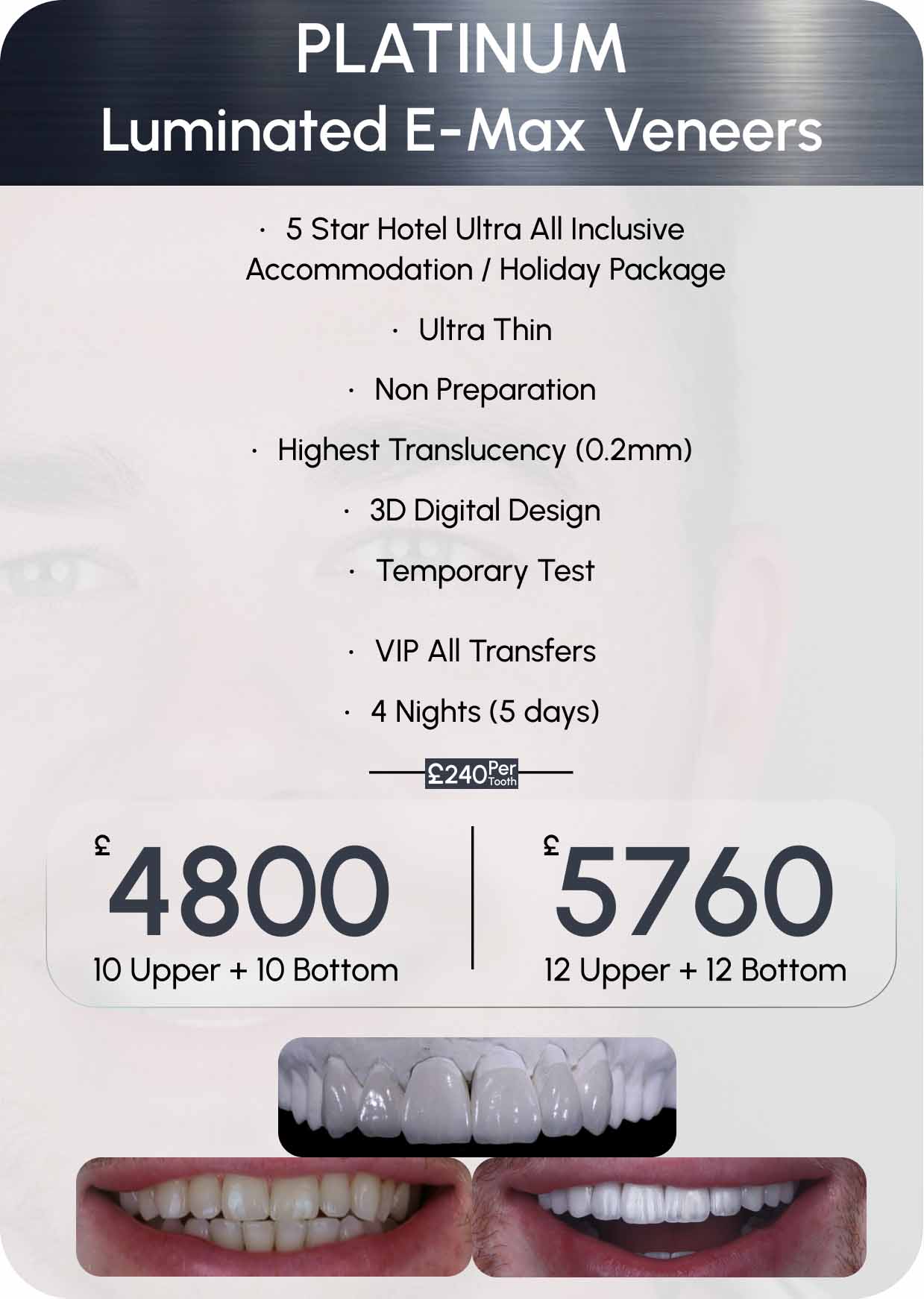 Laminated E-Max Cost