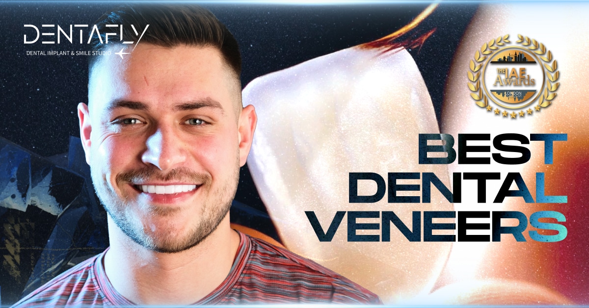 best dental veneers