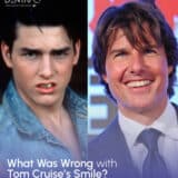 Tom Cruise got which treatment