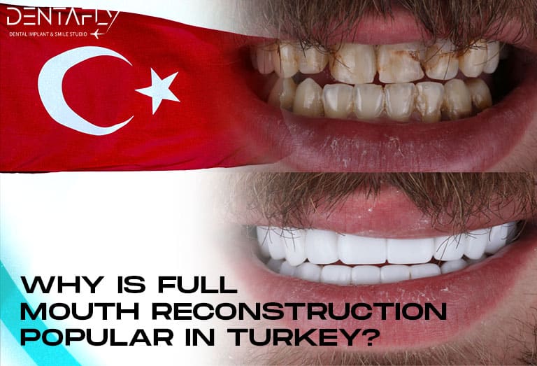 Full Mouth Reconstruction Costs in Turkey