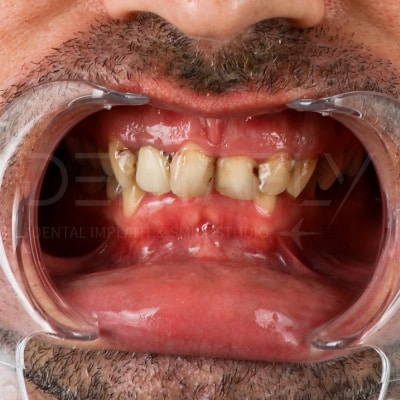 before-smiles before-smiles