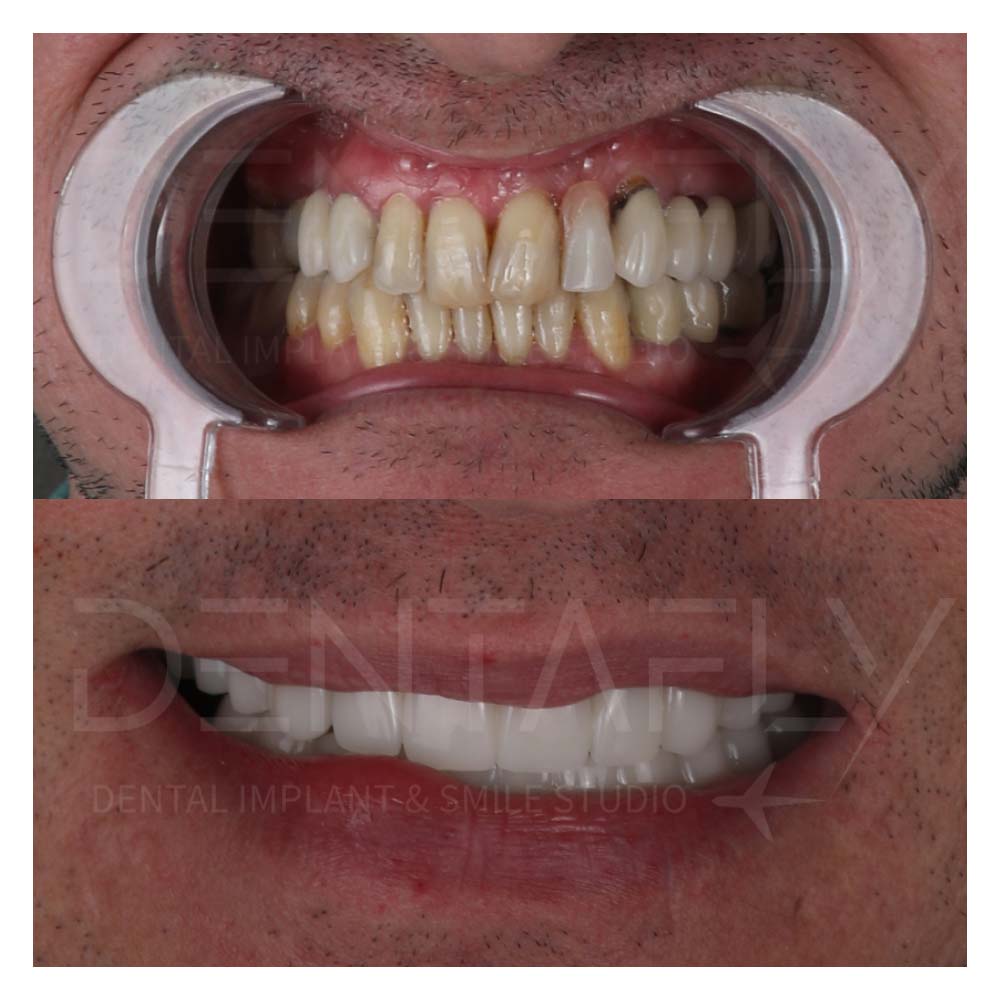 smile-design-7