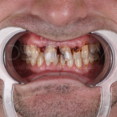 turkey-smiles-before turkey-smiles-before