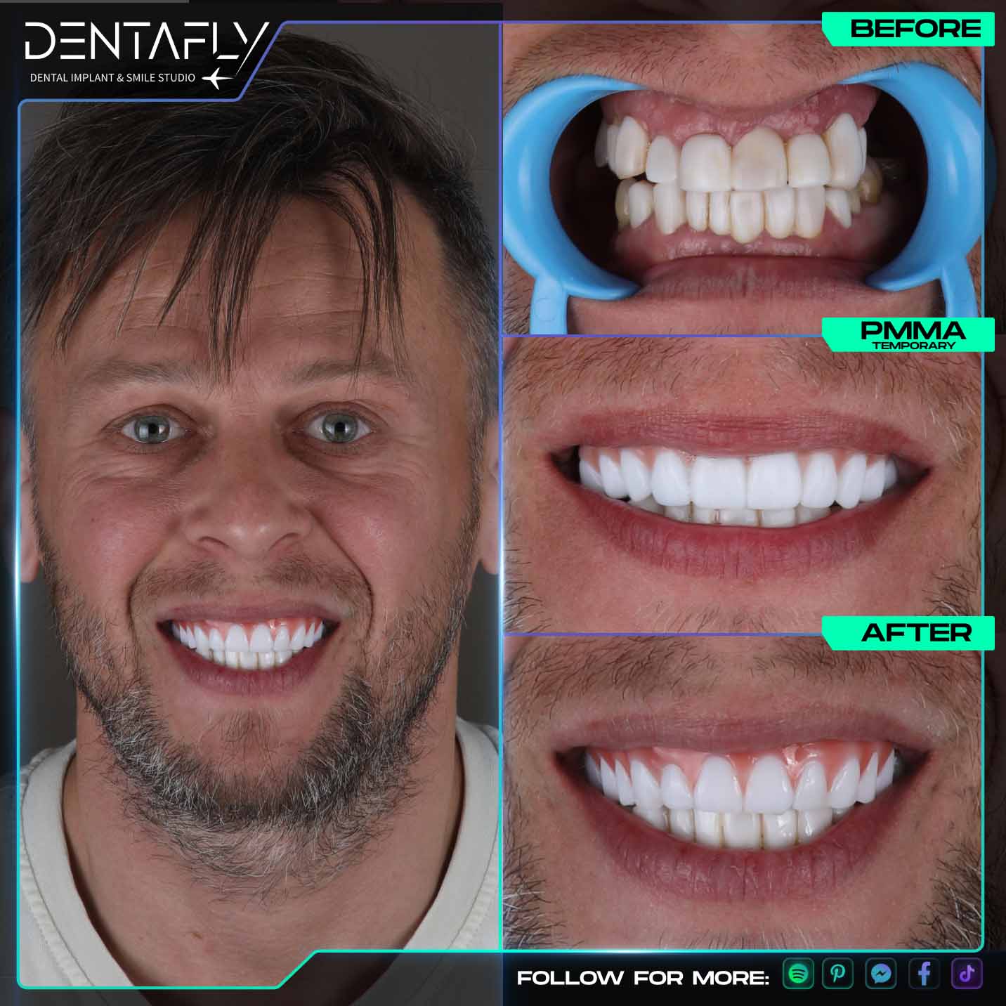 Zsolta Review Zsolta Review