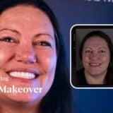 https://07cc7e7a.delivery.rocketcdn.me/wp-content/uploads/2025/01/What-to-expect-during-your-Smile-Makeover-Journey-6-160x160.jpg