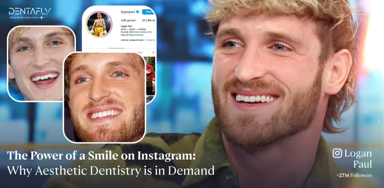 Instagram Smile 