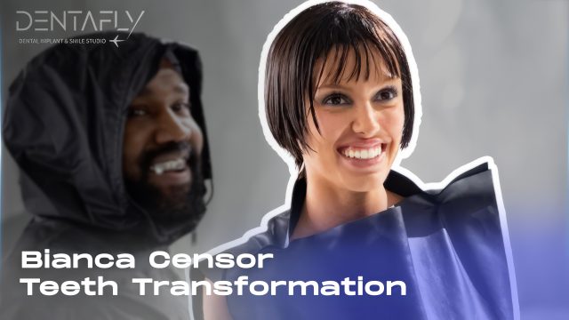 Censori's daily life change