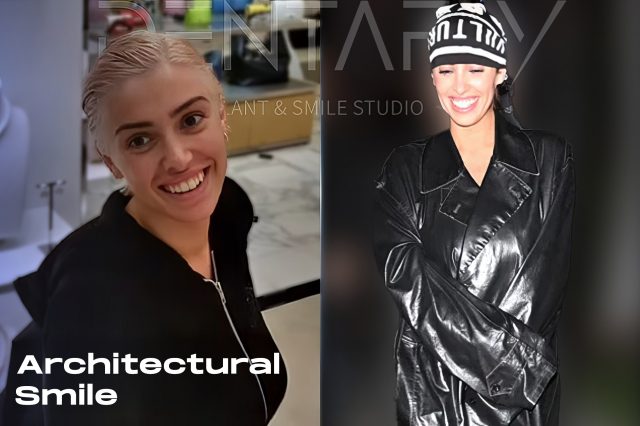 Architectural transformation